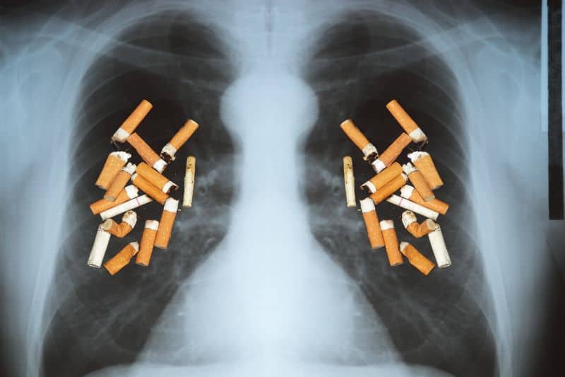 Lung cancer from smoking